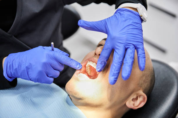 Best Broken Tooth Emergency  in Troy, OH