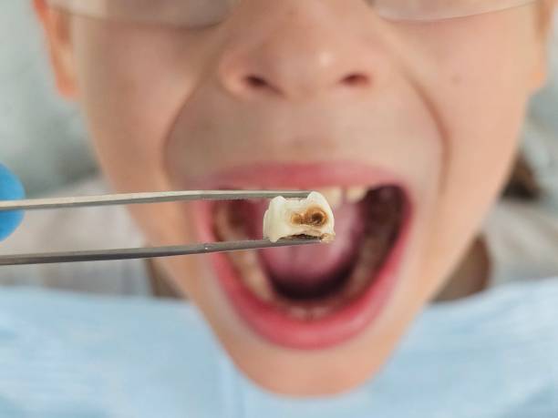 Best Teeth Whitening  in Troy, OH